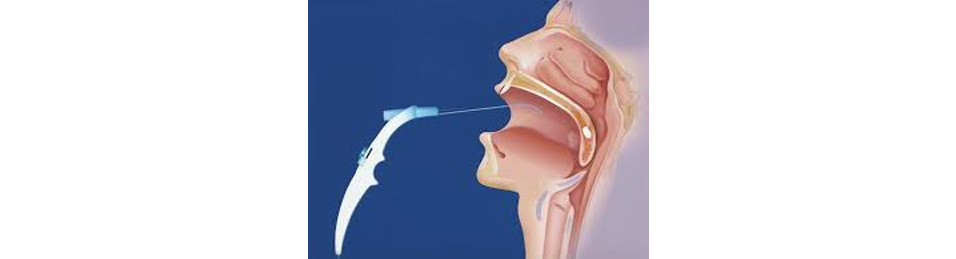 Soft Palate Somnoplasty